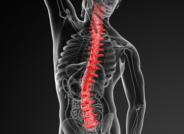 Spina System